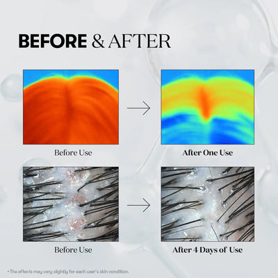 SKINIVATE™ PDRN REEDLE SHOT HAIR AMPOULE