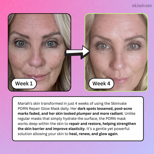 SKINIVATE™ PDRN REPAIR GLOW MASK